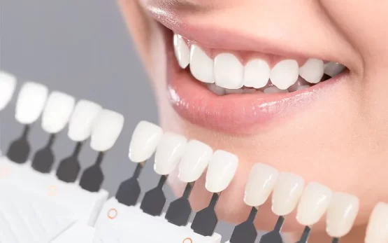 The best dental composite brand