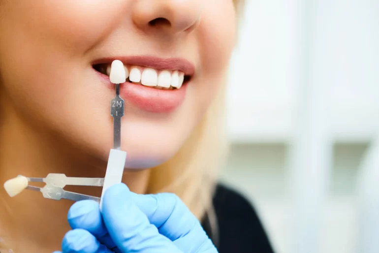 آیا کامپوزیت دندان را خراب می کند؟
