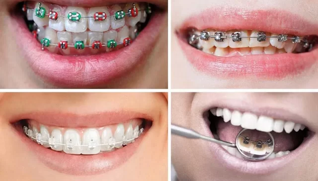 ارتودنسی دندان