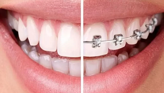 متخصص ارتودنسی در شمال تهران